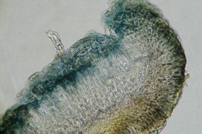 <i>Lecidella elaeochroma</i>