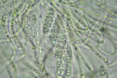 <i>Gyalecta truncigena</i>