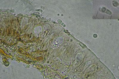 <i>Diarthonis spadicea</i>