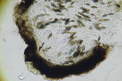 <i>Peridiothelia fuliguncta</i>
