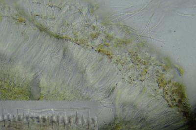 <i>Bacidia arceutina</i>