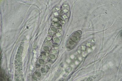 <i>Pyrenula chlorospila</i>