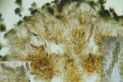 <i>Abrothallus microspermus</i>