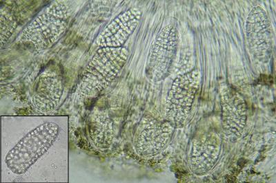 <i>Phlyctis agelaea</i>