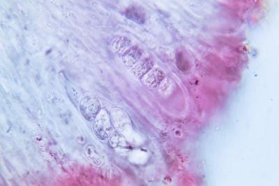 <i>Protoblastenia rupestris</i>