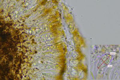 <i>Clauzadea metzleri</i>