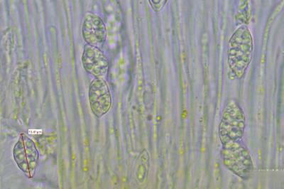 <i>Gyalecta liguriensis</i>