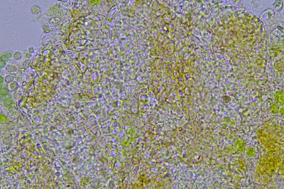 <i>Scytinium teretiusculum</i>