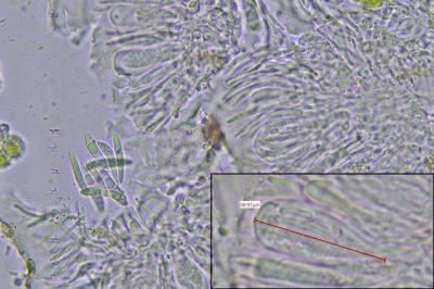<i>Scoliciosporum chlorococcum</i>