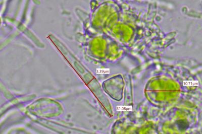 <i>Scoliciosporum chlorococcum</i>
